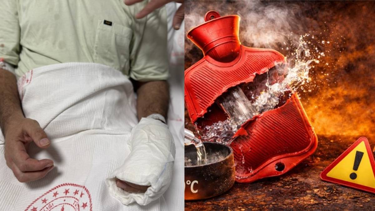 Isınmaya çalışıyordu vücudunun yüzde 30’u yandı! Sıcak su torbası kullanırken sakın bu hataya düşmeyin