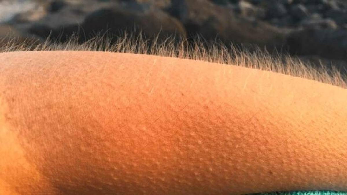 Evrimsel bir miras! Üşüyünce ya da korkunca neden tüylerimiz diken diken olur? Vücudun gizli mesajını gözlemleyin