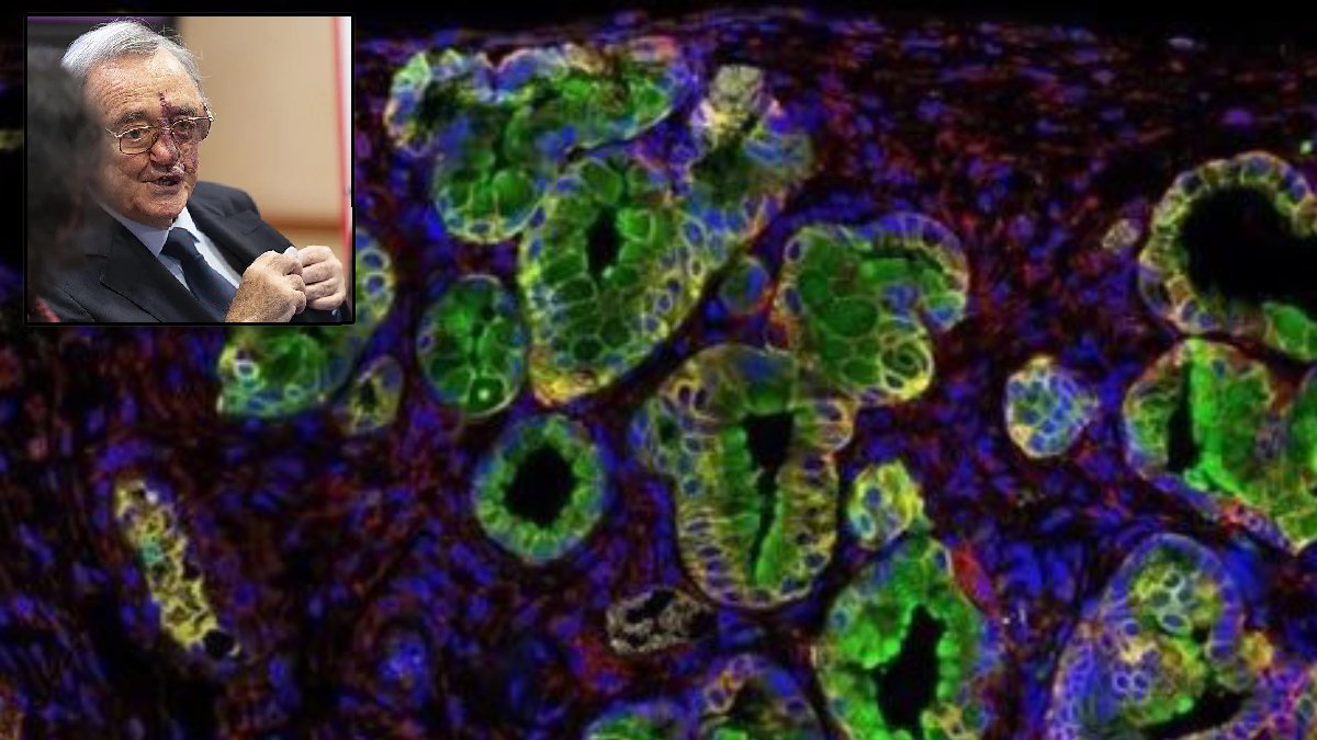 Bilim dünyasında tarihi gün: En ölümcül kanser türü ilk kez tamamen yok edildi