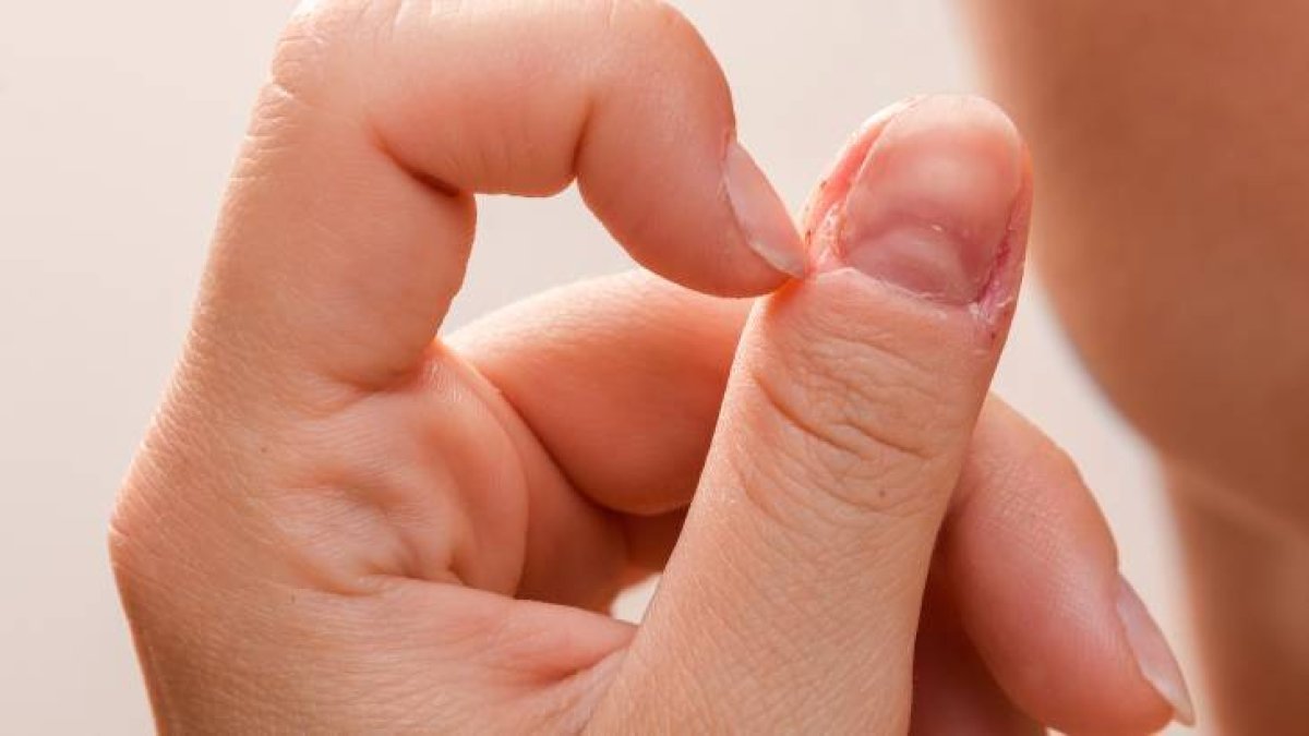 Tırnakların yanında pütür pütür görüntüye son! Tırnak etleriniz neden soyuluyor? Dünyaca ünlü manikür uzmanından altın tavsiye