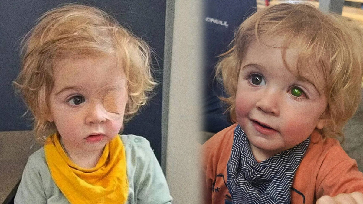 Uçuklu tanıdığı tarafından öpülen çocuk görme yetisini kaybetti!