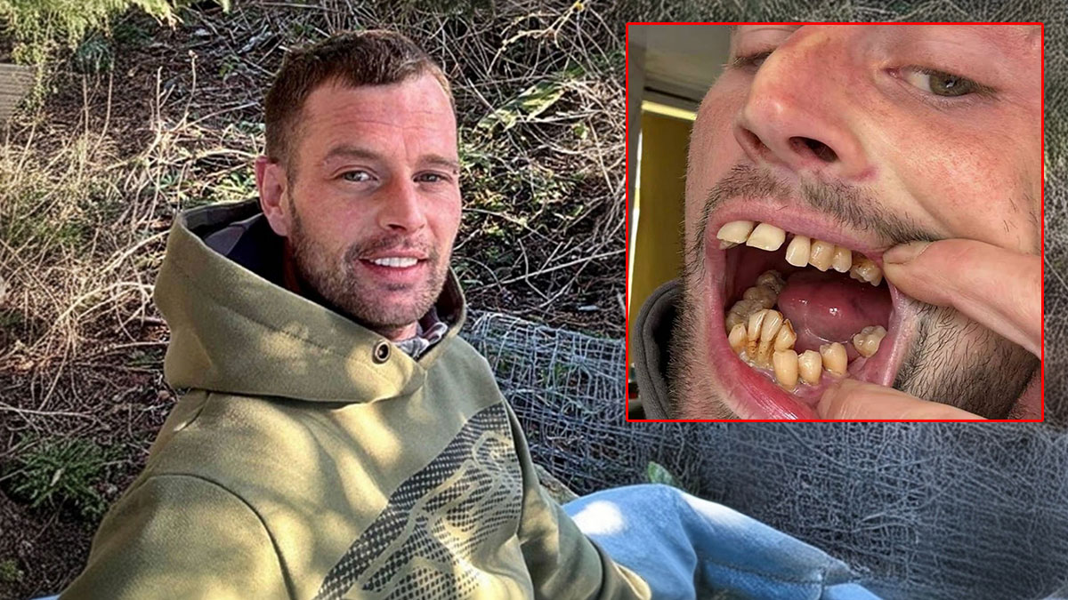 Türkiye'ye gelen İngiliz turistin yeni hali şaşırttı! 'At ağızlı' deniyordu, şimdi Hollywood gülüşüne sahip