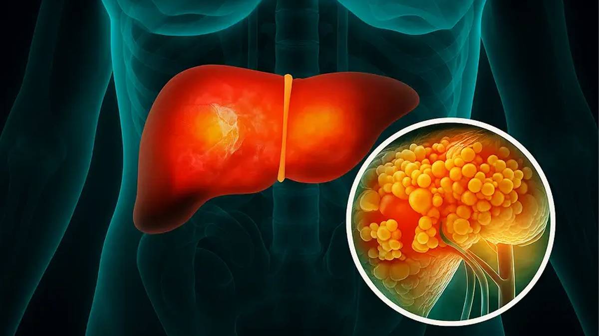 Damarları pırıl pırıl yapıyor! İşte kolesterolü düşüren o mucize besinler