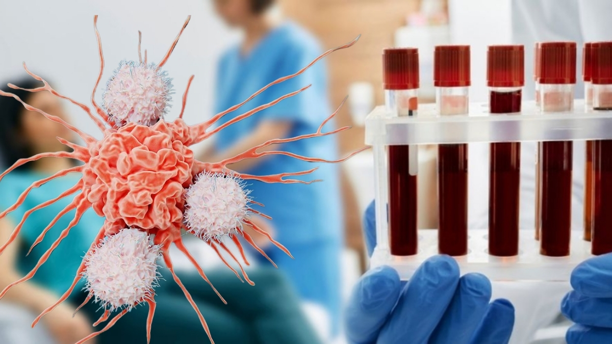 Vakalar her geçen gün artıyor! Türkiye’de 240 bin yeni tanı çıktı: Dünyada 20 milyon insan bununla mücadele ediyor