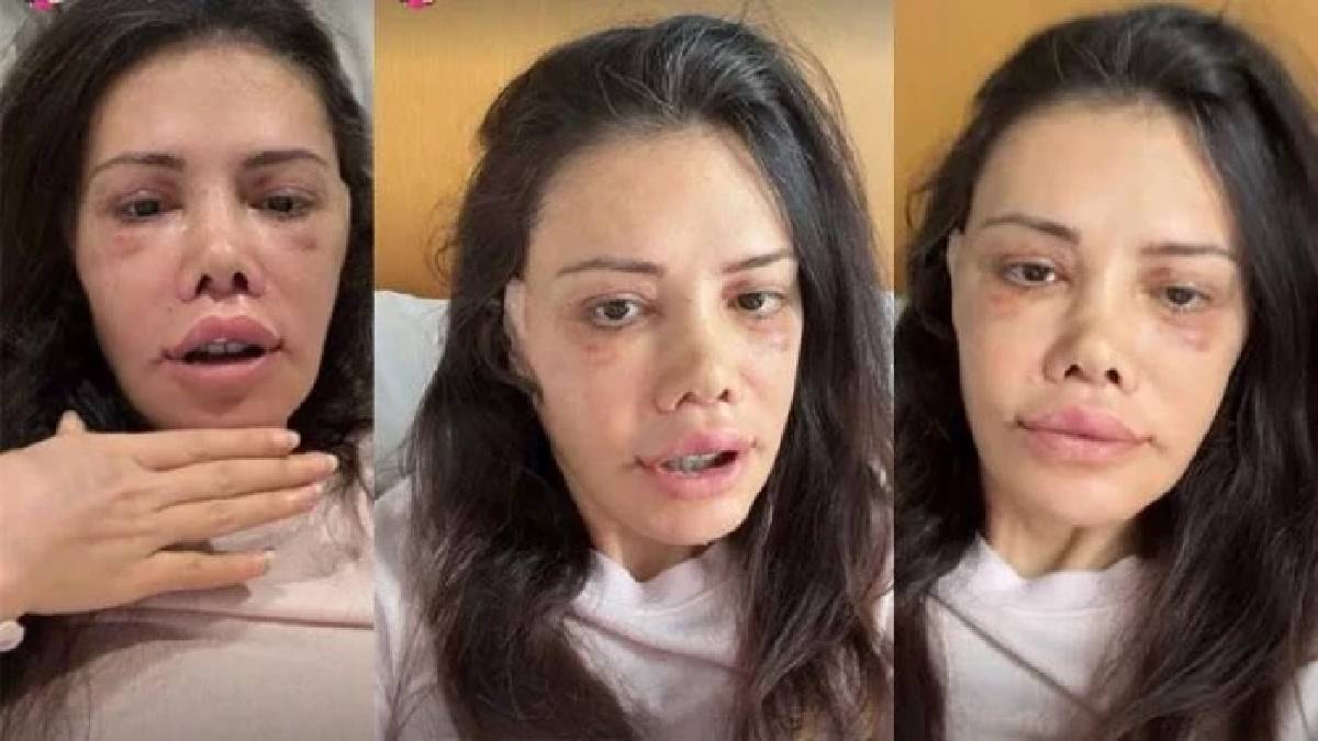 Yüz nakli olan Didem Ceran’dan 14 Şubat paylaşımı! ‘Yanımda duran bir adamın yanında, yalnız hissettim’