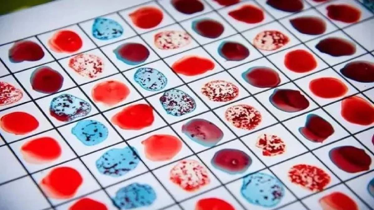 Kan grubu kalp krizi riskini etkiler mi? Damar tıkanıklığına en uzak olan kan grubu belli oldu