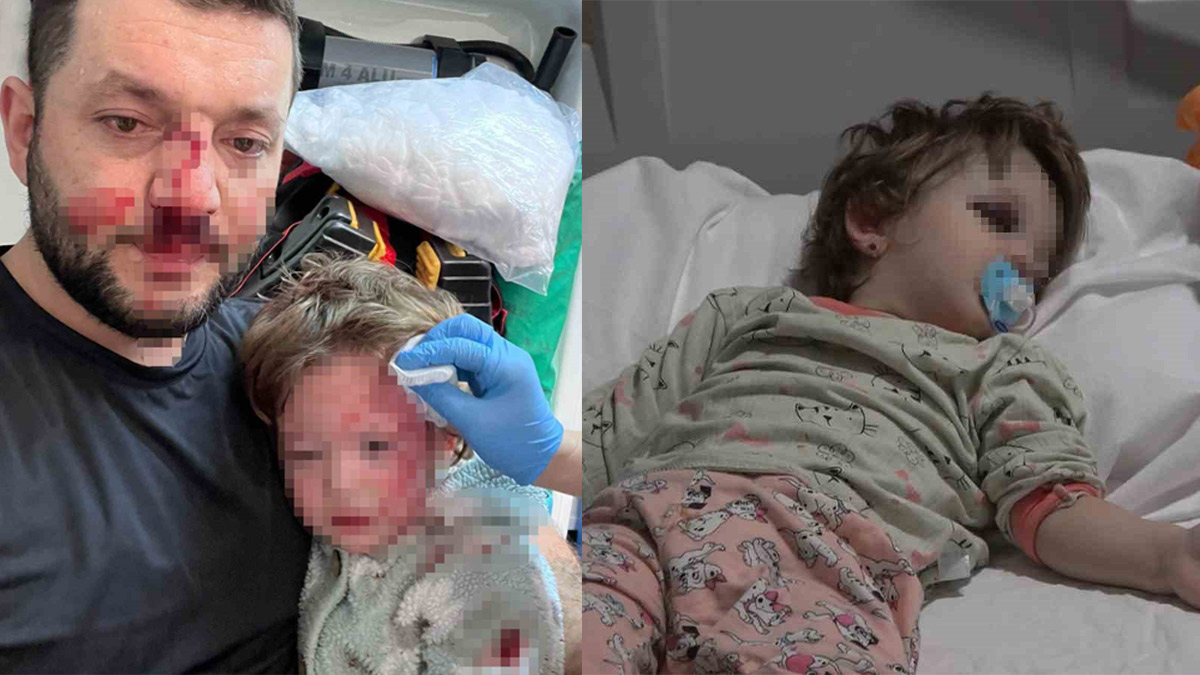 Gürültü tartışması dehşete döndü: 14 aylık bebeğin kafatası çatladı! Jandarmanın yanında baba ve kızına sopalı saldırı