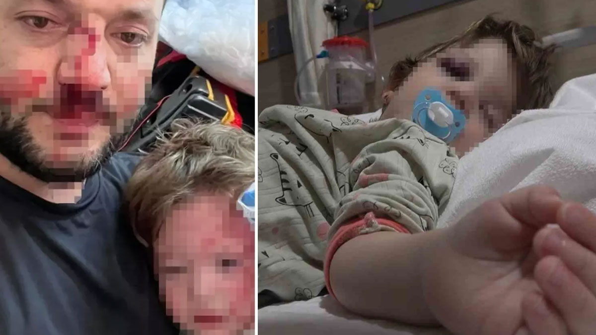 Yalova'daki komşu saldırısında skuter 'silah' sayıldı: Savcıdan 36 yıl talebi