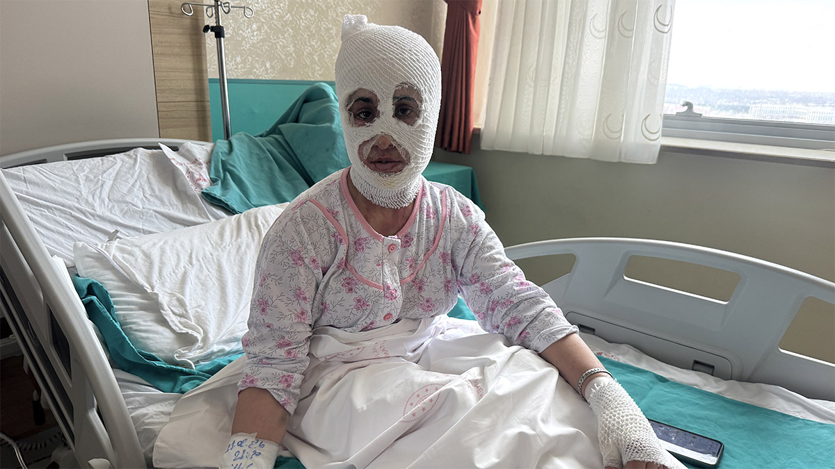 İftar hazırlığında düdüklü tencere patladı! Genç kadın ağır yaralandı: 'Ben yandım başkası yanmasın'