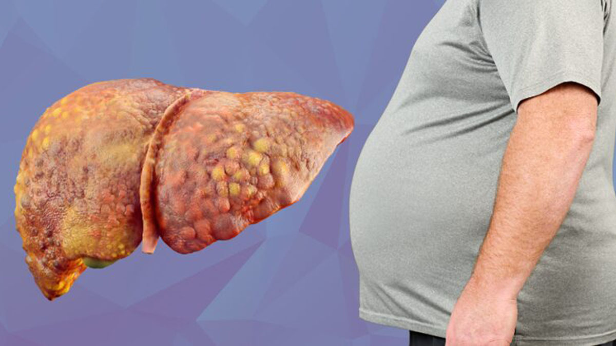 Bu besinler karaciğerdeki yağı kar gibi eritiyor! Karaciğer temizliğinin şifresi bu besinlerde saklı