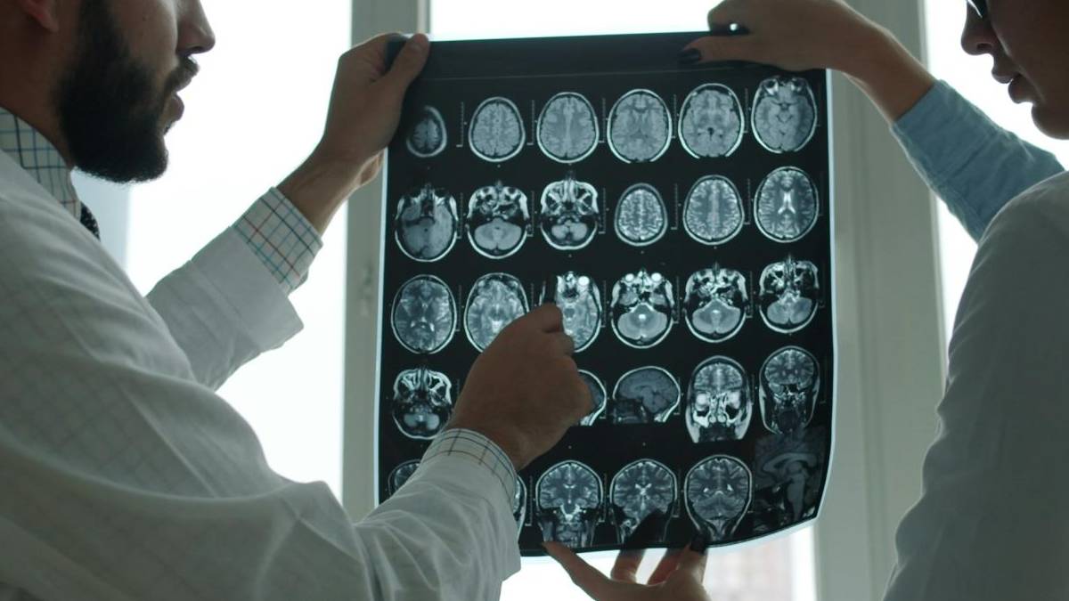 Yapay zeka Alzheimer riskini erken tespit edebilir