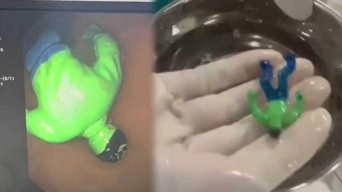 Yenilmez Hulk, 1,5 yaşındaki bebeğin midesine yenildi