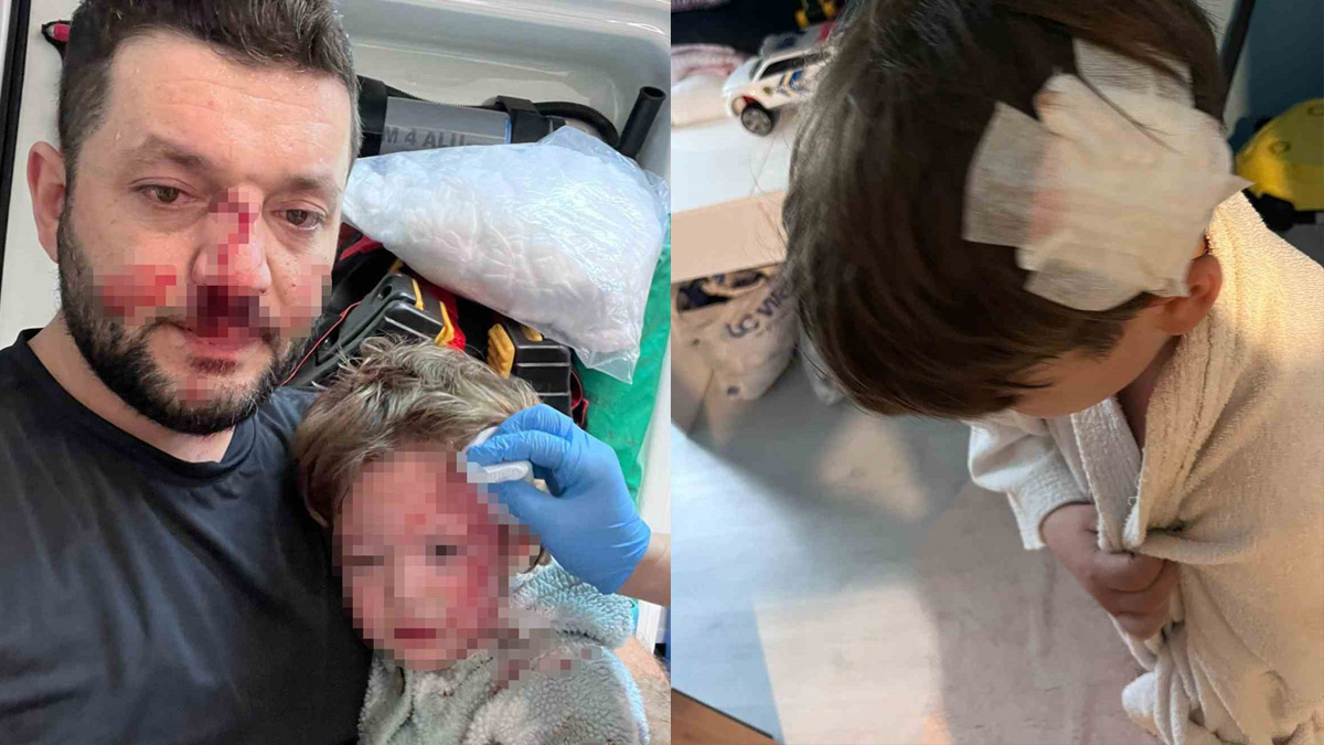 Scooterlı komşu kavgasında yeni gelişme: 8 yaşındaki çocuk taşla yaralandı, aile evi satışa çıkardı