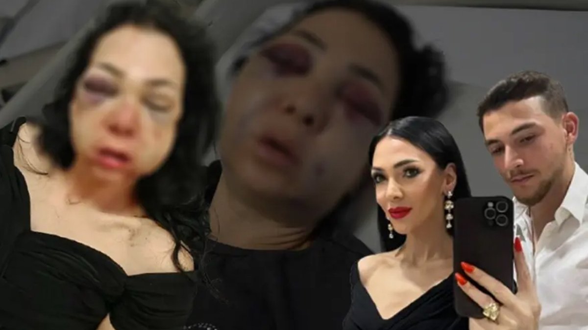 Kocaeli'de infial yaratan olay: Oğlunun gözü önünde anneyi öldüresiye dövdüler