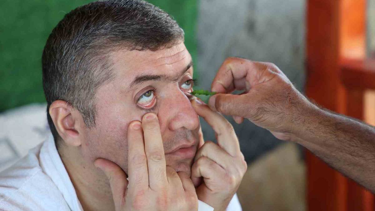 Şifalı diye gözüne damlattı, dünyası karardı! Uzmanlardan kırlangıç otu uyarısı
