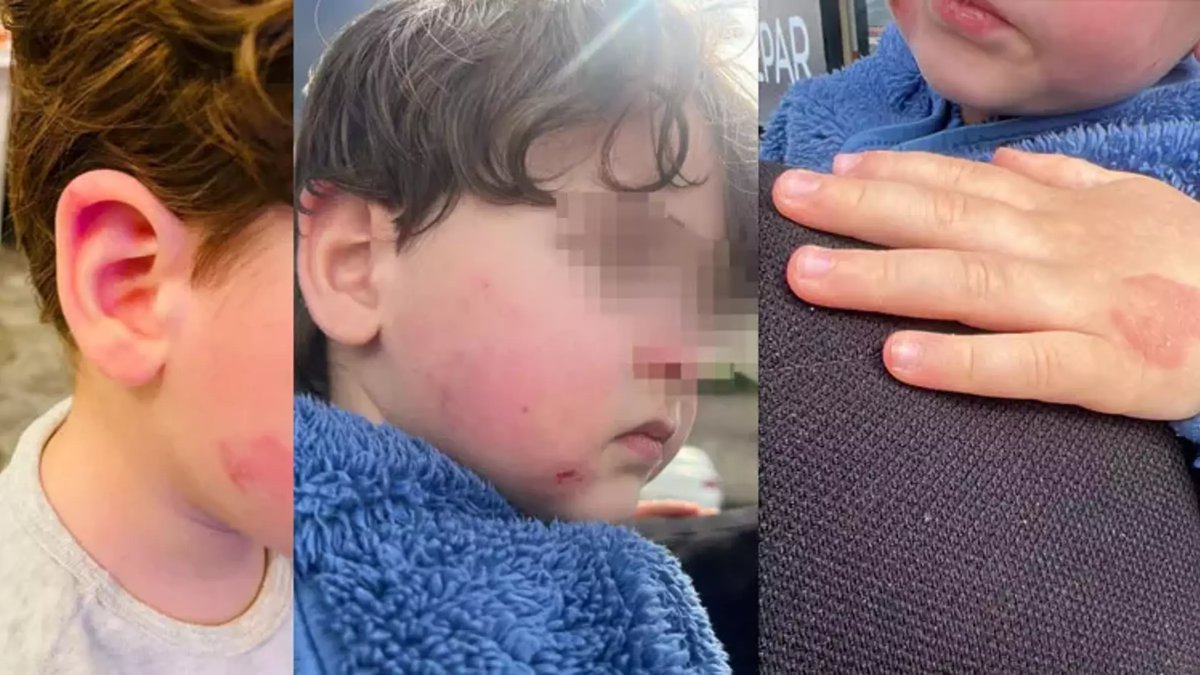 Kreşte 2,5 yaşındaki çocuğa darp: Kurumun '2 dakika' savunması pes dedirtti