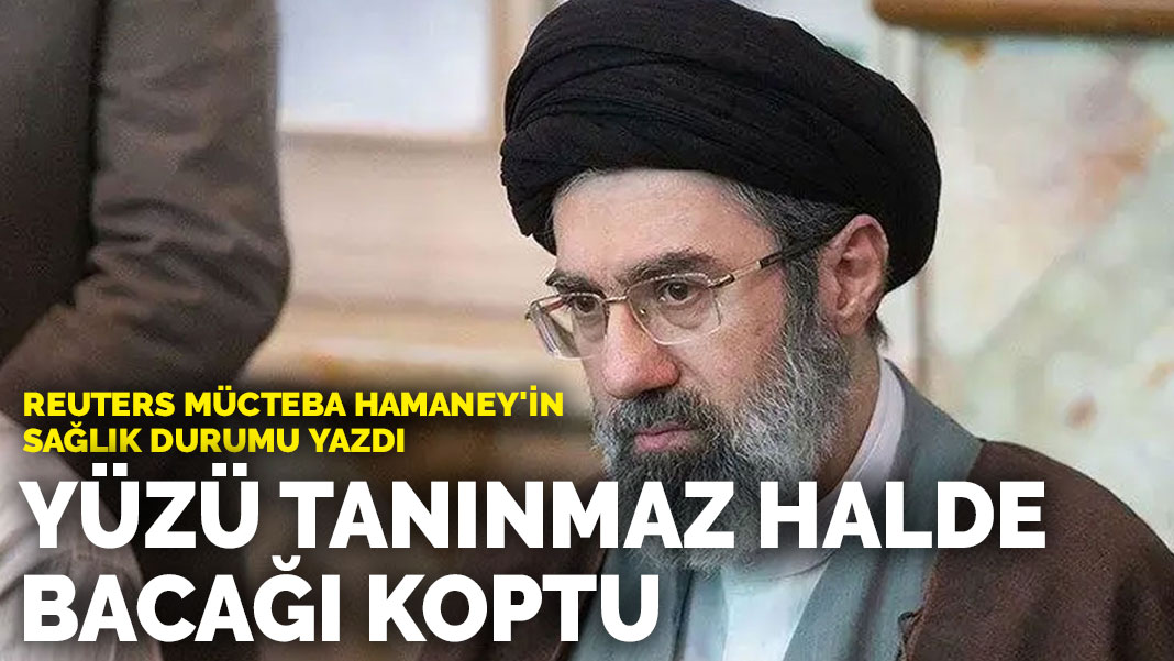 Reuters Mücteba Hamaney'in sağlık durumu yazdı: Yüzü tanınmaz halde, bacağı koptu