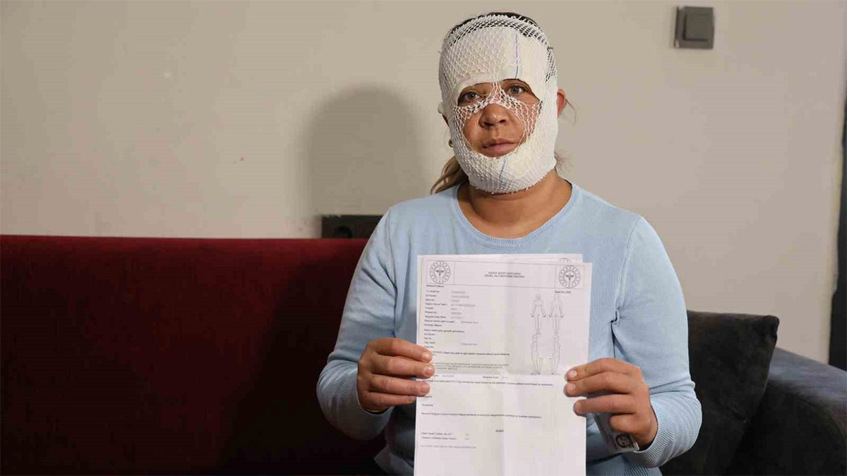 Prenses cilt bakımı kabusa döndü: "Oğlum 'öcü' diyerek benden kaçtı"