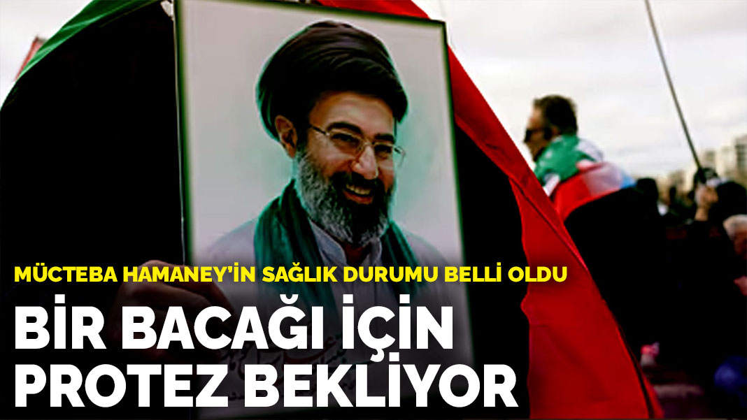 Mücteba Hamaney'in sağlık durumu belli oldu: Bir bacağı için protez bekliyor