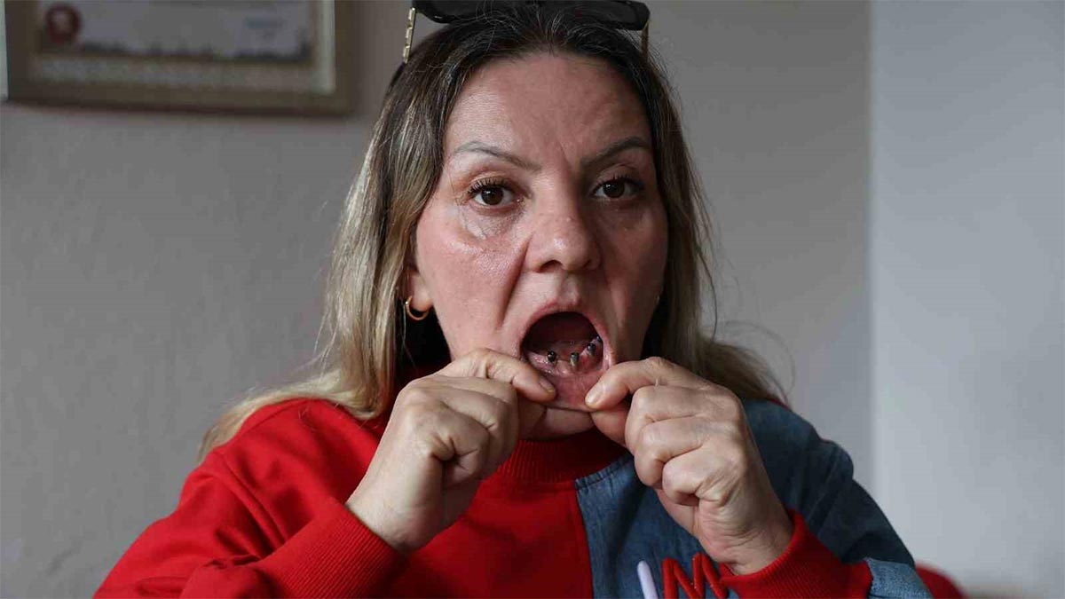 Diş tedavisi kabusa döndü! 25 dişi birden çekildi, 'ağrıların psikolojik' denildi
