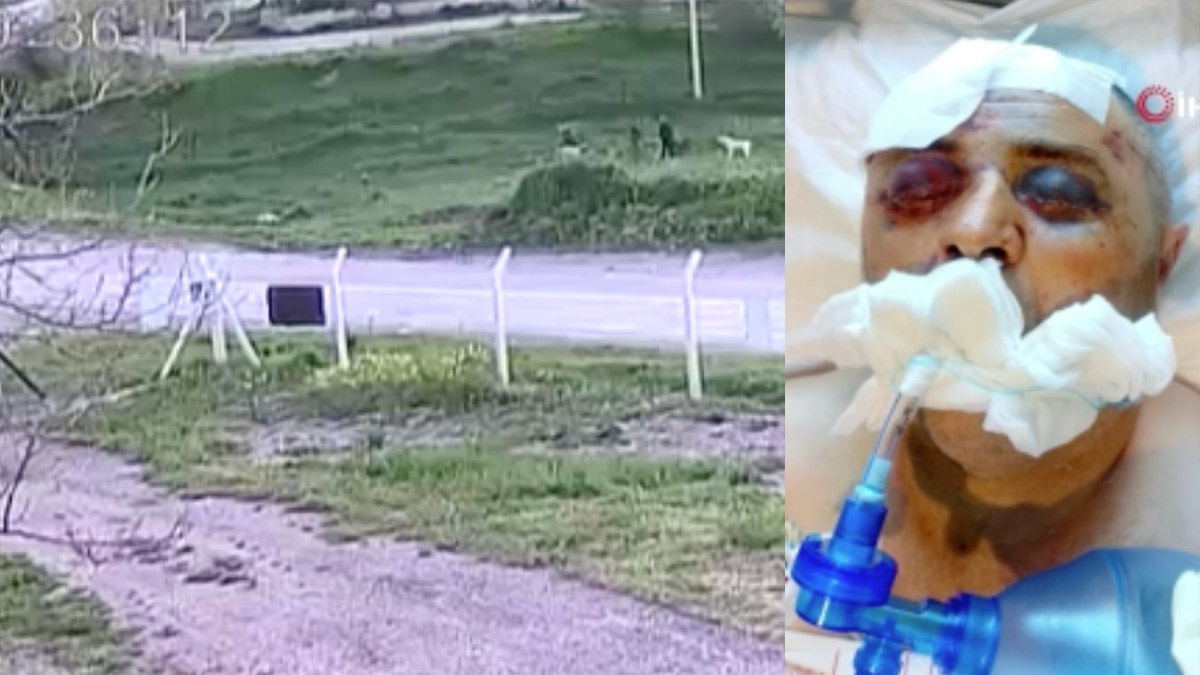 Ankara'da köpek kavgası kanlı bitti! Komşusunu demir çubukla darp etti