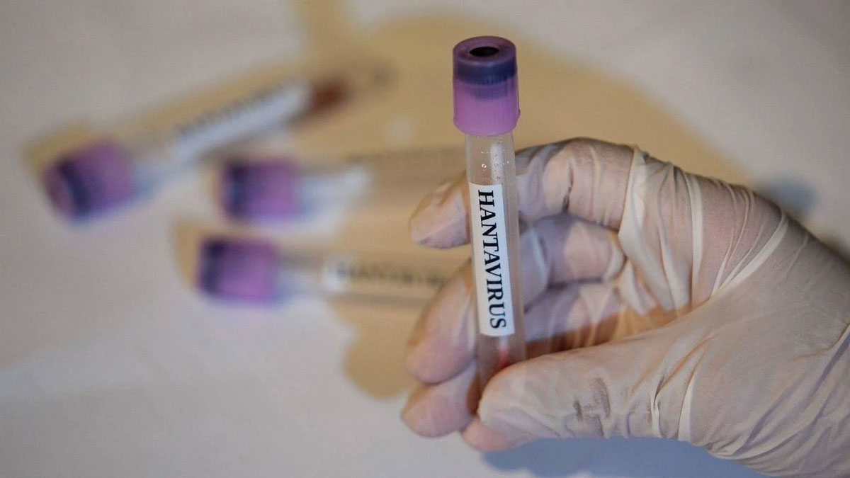 DSÖ'den 'hantavirüs' açıklaması: Küresel risk düşük