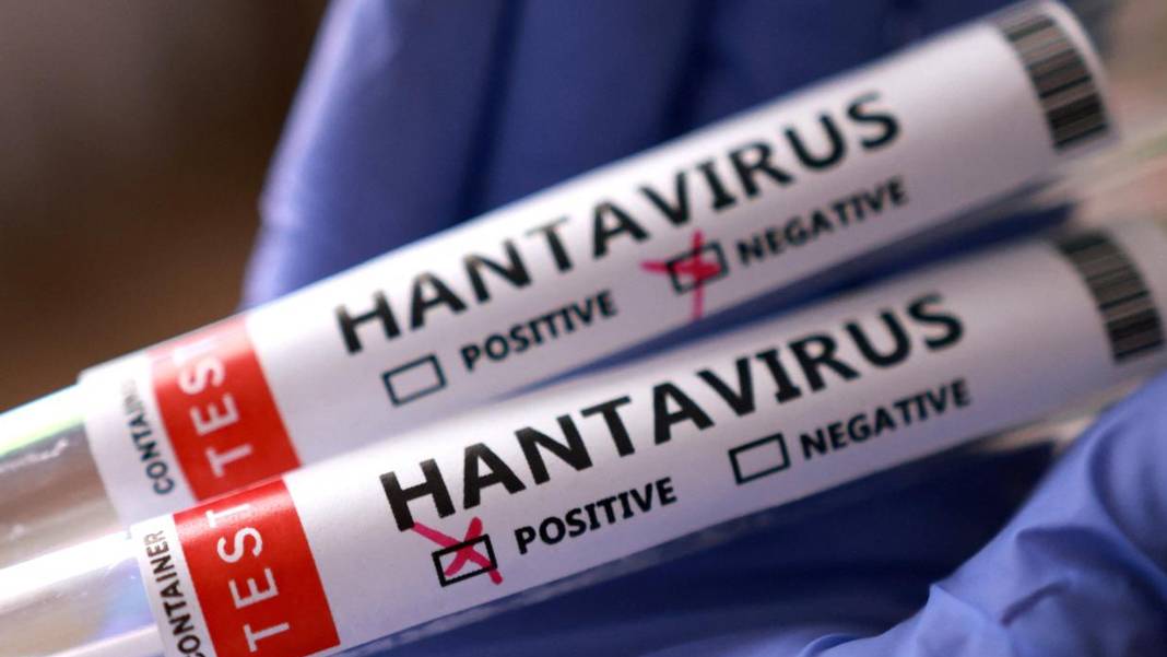 DSÖ: Hantavirüs bir pandemi başlangıcı değil