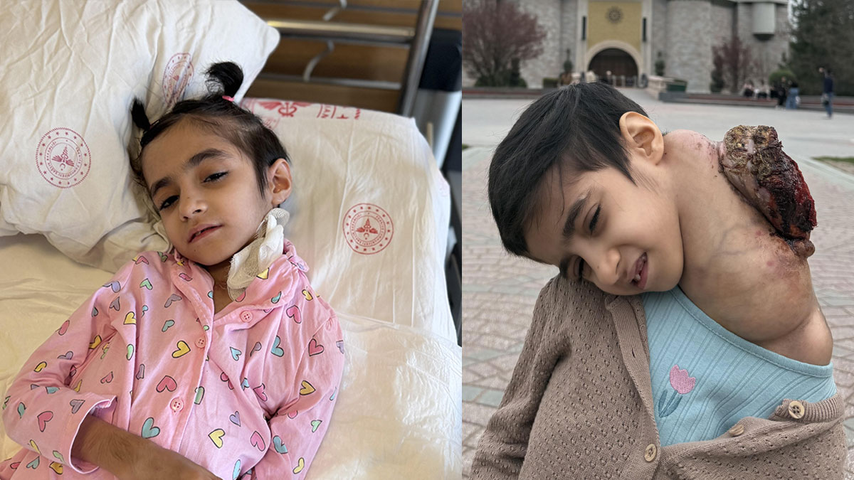 8 yaşındaki Fatma'nın boynundan 3 kiloluk dev kitle çıkarıldı: Vaka literatüre girdi