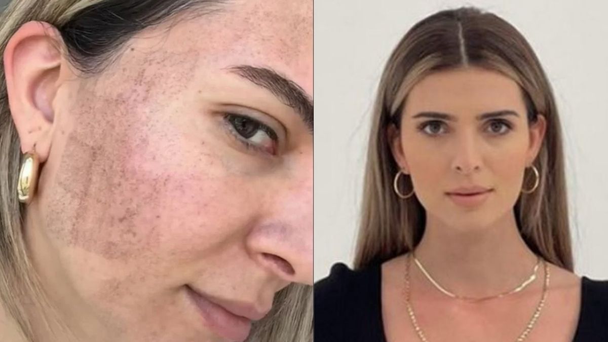 Merve Aydın güzellik için öyle bir şey yaptı ki! Yüzündeki değişim herkesi şaşırttı