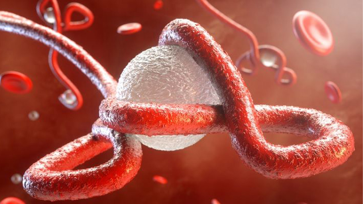 Uzm. Dr. Müberra Hraloğlu'ndan ebola uyarısı: Erken belirtiler grip ile karışabiliyor