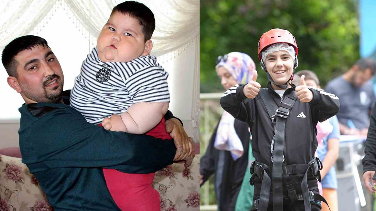 5 yaşında 90 kiloydu... Tokluk hissi olmayan Yağız tedaviyle sağlığına kavuştu