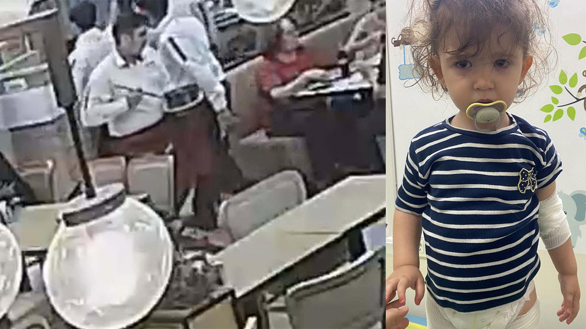 Restoranda korkunç olay! 2 yaşındaki çocuğun üzerine tereyağı döküldü
