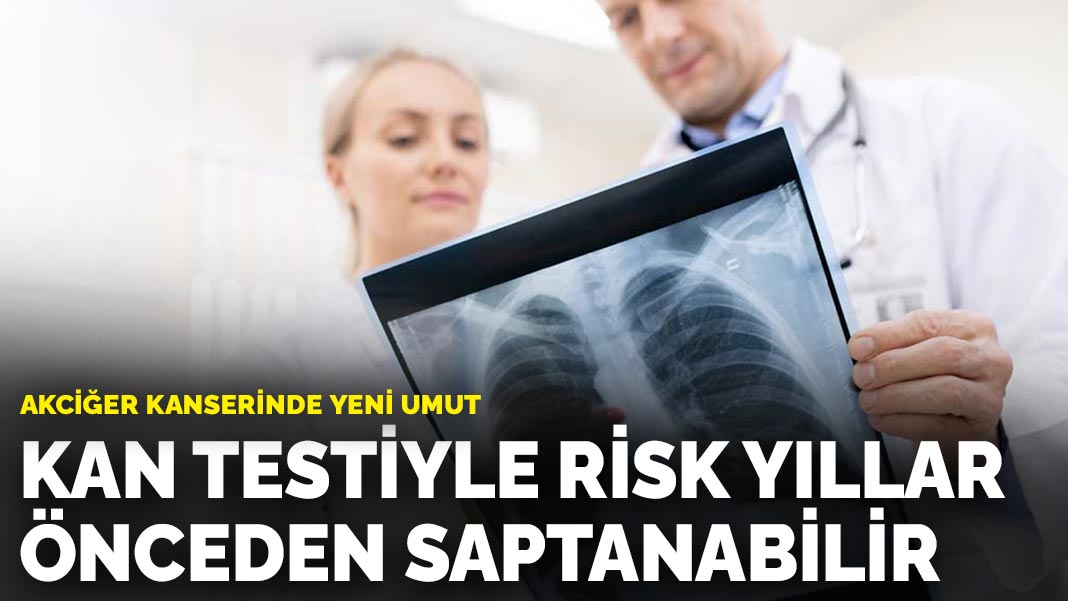 Akciğer kanserinde yeni umut: Kan testiyle risk yıllar önceden saptanabilir