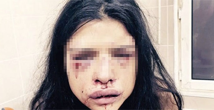 Onur Özbizerdik'in sevgilisi 
şikayetini geri çekti