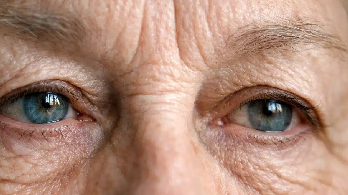 Alzheimer'ın ilk sinyalleri gözlerde ortaya çıkabilir
