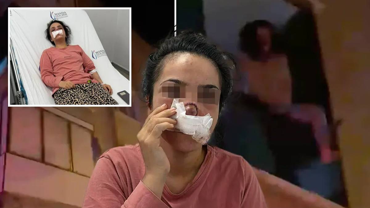 Manisa’daki kan donduran vahşet: Tartıştığı eşinin burnunu ısırarak kopardı