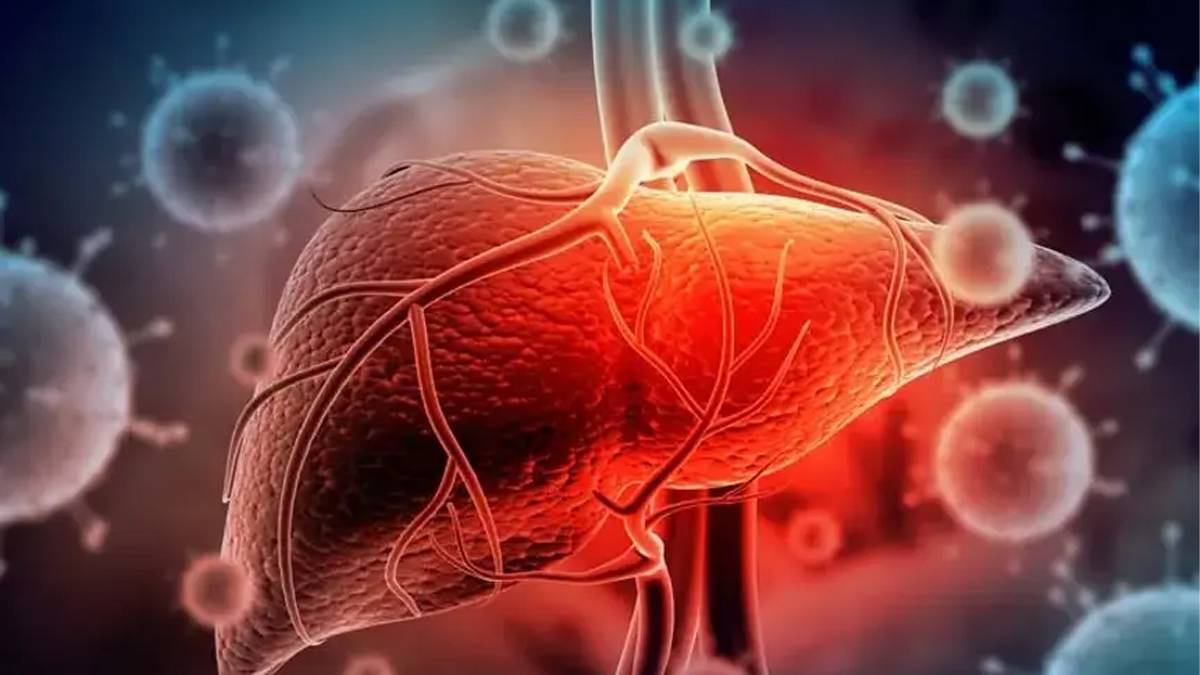 Dünya Hepatit Günü’nde hayati uyarı: Ağrı ve sarılık olmaması hepatit olmadığınız anlamına gelmez