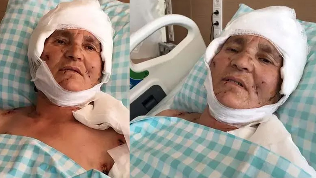 Yargıtay’dan karar: Köpek saldırısı sonrası yüzde 37 malul kalan kadına 637 bin lira tazminat