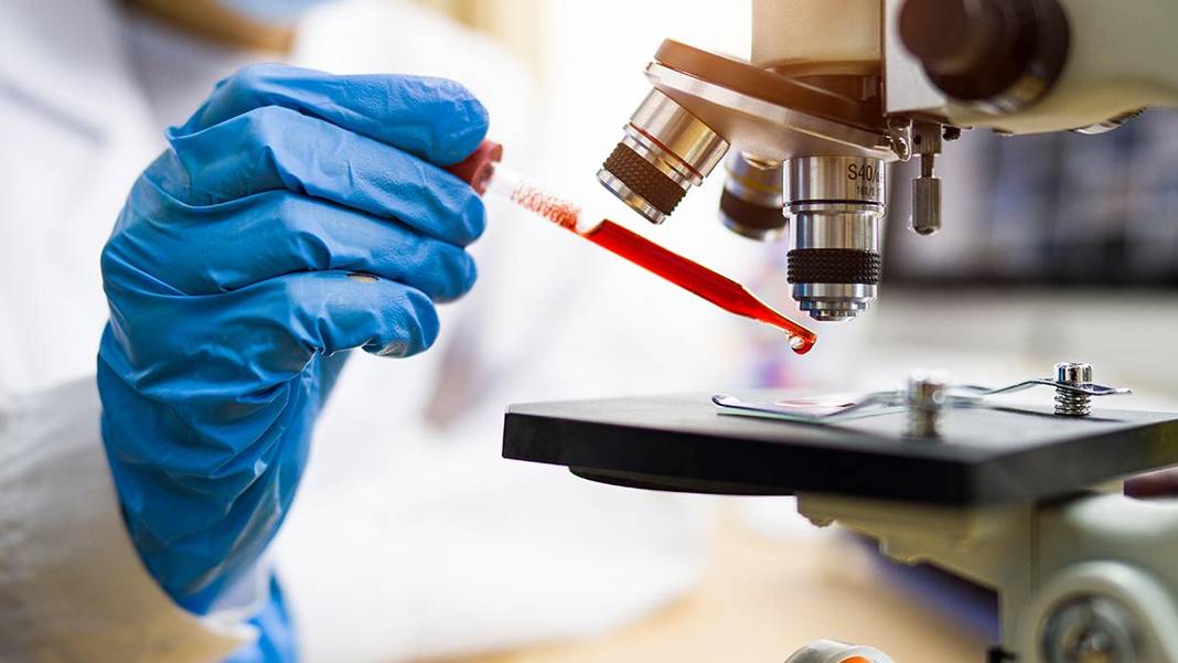 Yapay zeka organların yaşlanma haritasını çıkardı: Her organ farklı hızda yaşlanıyor