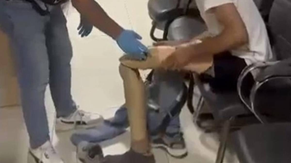 Narkotik ekiplerini bile şaşırtan yöntem: Protez bacağından 830 gram uyuşturucu çıktı