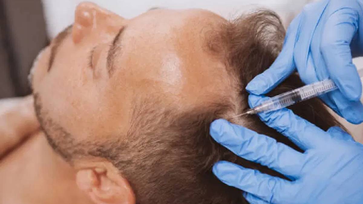 Obezite ilaçları gibi olabilir mi? İlaç devleri bu kez kellik için yarışıyor