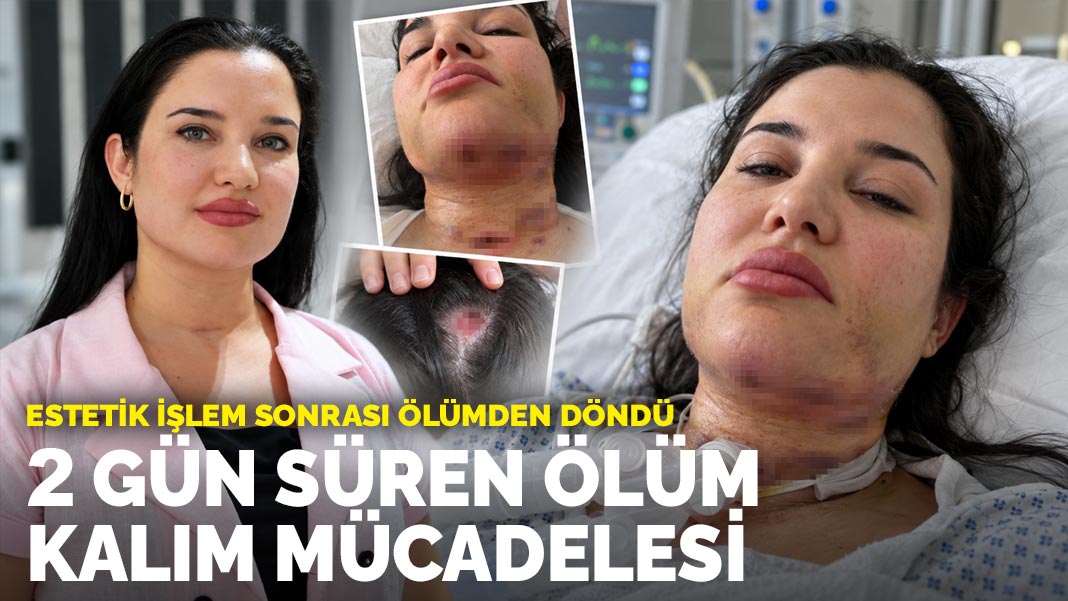 Estetik işlem sonrası ölümden döndü: İki gün süren ölüm kalım mücadelesi