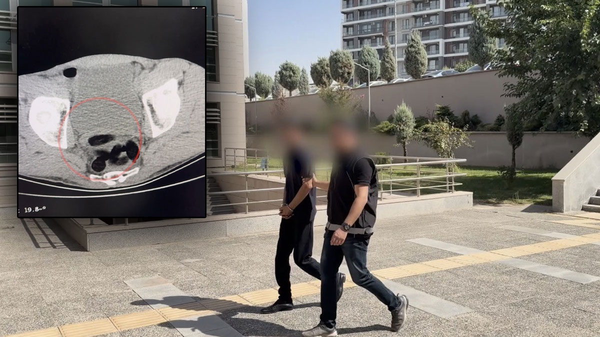 Batman’da uyuşturucu kaçakçılığında akılalmaz yöntem: Midesinden eroin çıktı