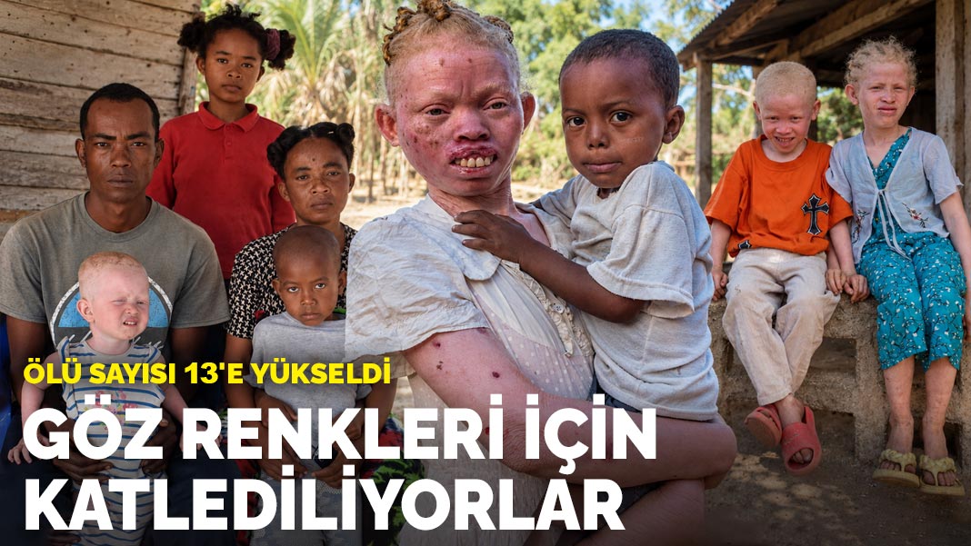 Göz renkleri için katlediliyorlar: Ölü sayısı 13'e yükseldi