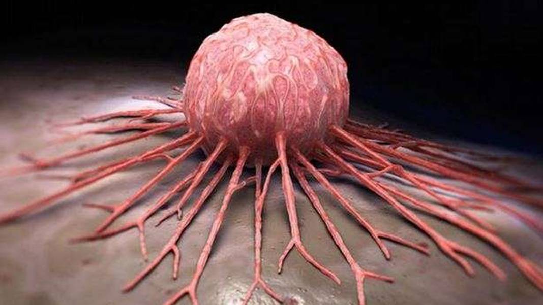Bilim insanları kolon kanserinin yayılma sırrını çözdü: Vücudun onarım sistemi ele geçiriliyor