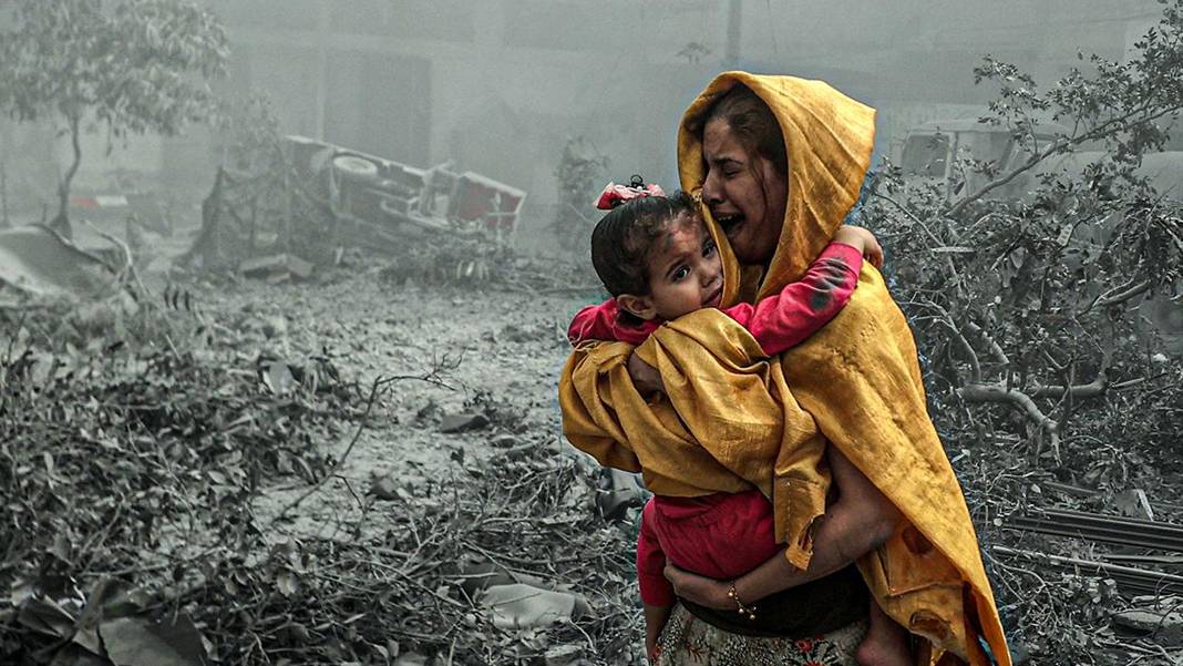 Gazze'de 10 binden fazla çocuk uzuv kaybı yaşadı
