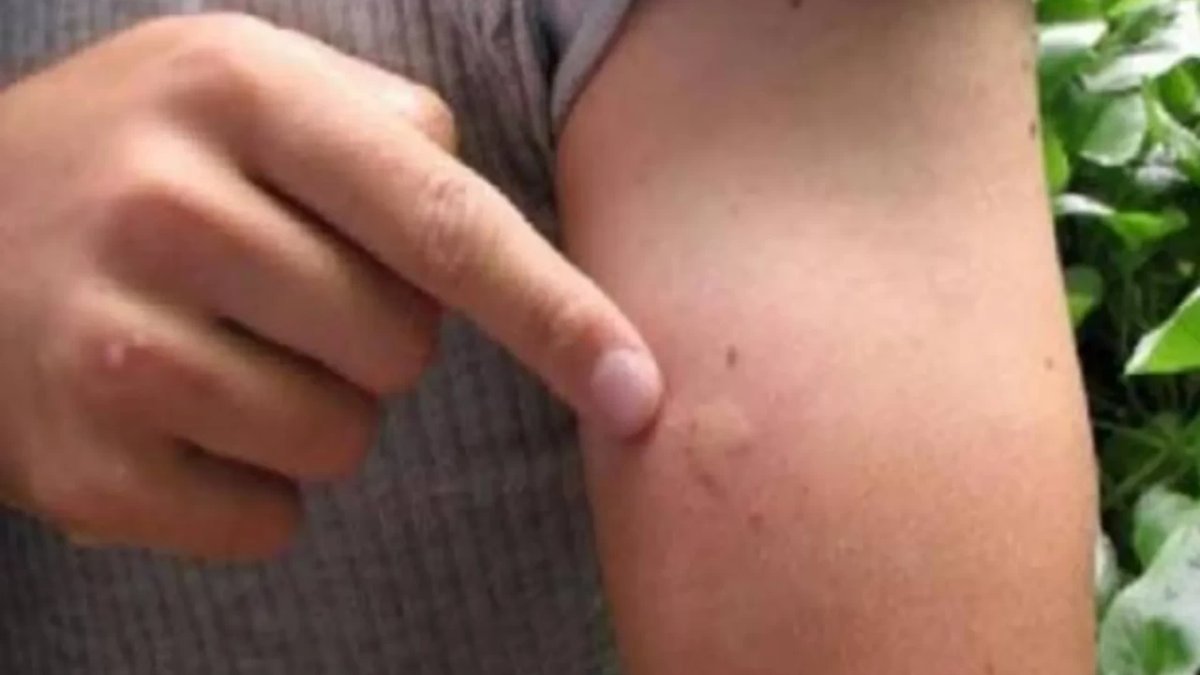 Sınırımızdaki ölümcül tehlike hızla yayılıyor: O sinsi virüs için kırmızı alarm verildi