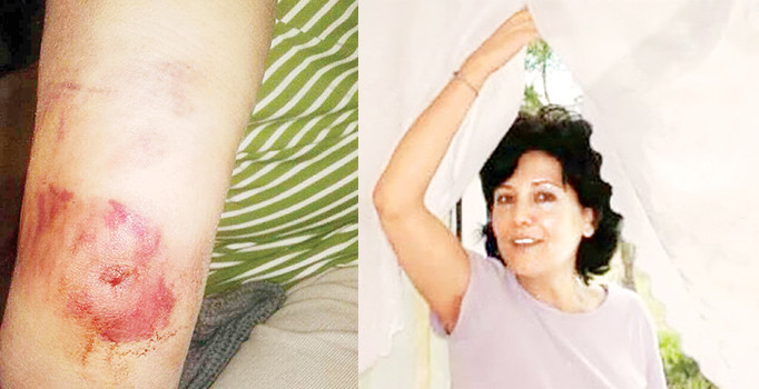 Funda Güneş'e otomatik polis koruması