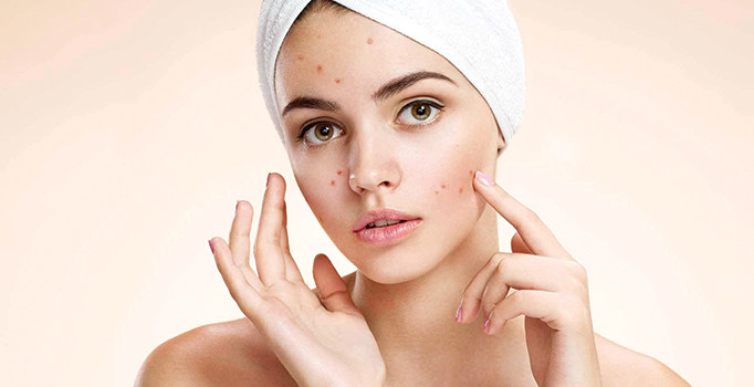 Sivilce yaşlanmayı önlüyor