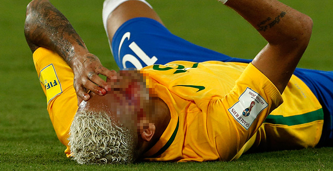 Neymar kanlar içinde yerde kaldı!